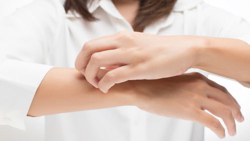 皮肤过敏怎么治疗 听医生讲