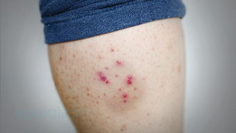 皮肤反复过敏是什么原因