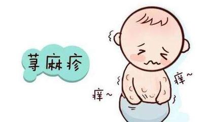 肇庆皮肤病医院:做哪些检查诊断湿疹荨麻疹 如何治疗