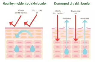 修复敏感肌的护肤陷阱,平时都有哪些地方需要注意呢
