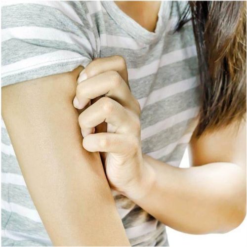 冬季荨麻疹原因不仅仅是怕冷，这三个原因与调理方法你要知道